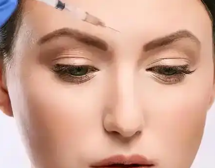 眼袋