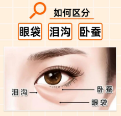 眼袋