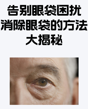 眼袋