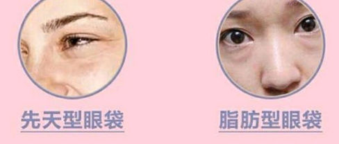 眼袋
