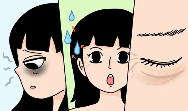 去眼袋手术