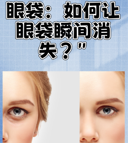 眼袋