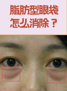 眼袋