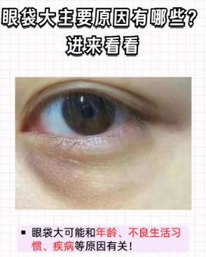 去眼袋手术