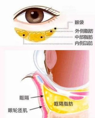 眼袋