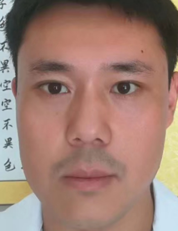 去眼袋手术