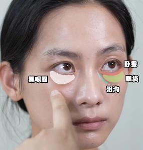去眼袋手术