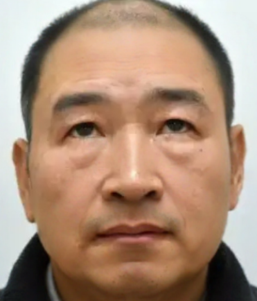去眼袋手术