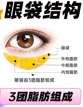 去眼袋手术