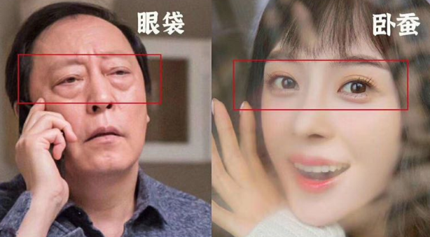 去眼袋手术