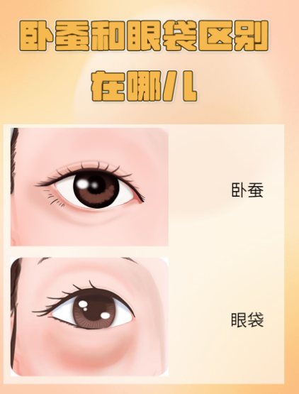 去眼袋手术