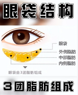 眼袋