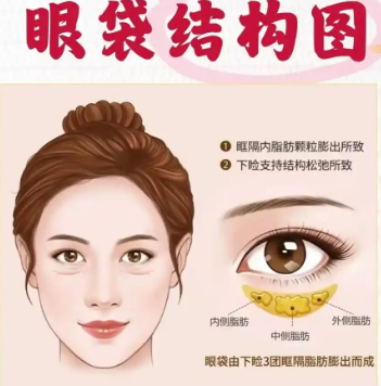 眼袋
