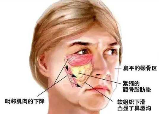 去眼袋手术
