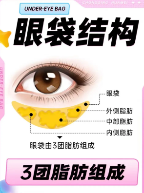 去眼袋手术