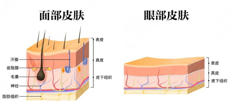 去眼袋手术