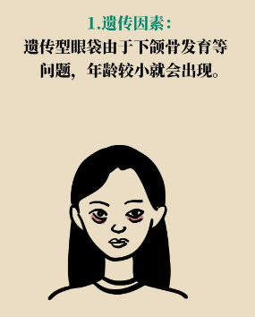 去眼袋手术