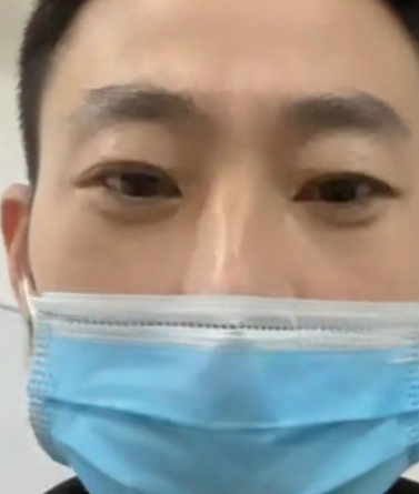 去眼袋手术
