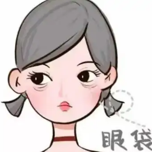 去眼袋手术