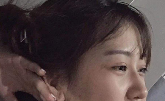 去眼袋手术