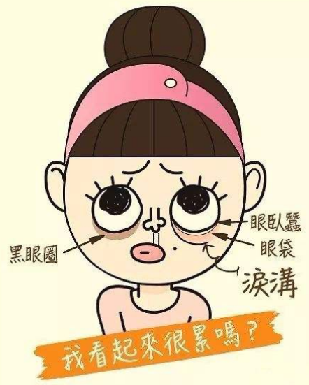 去眼袋手术