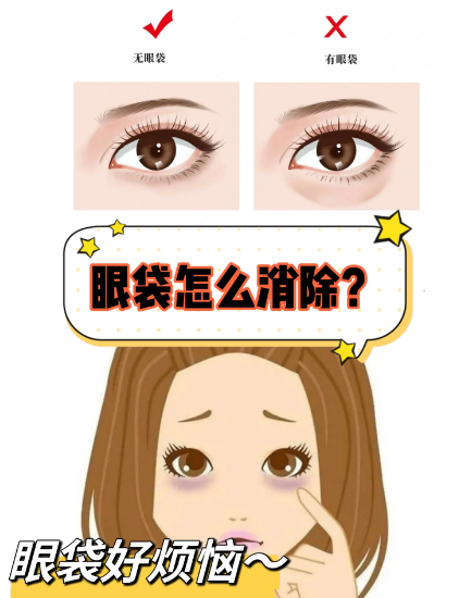 去眼袋手术