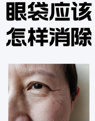 去眼袋手术