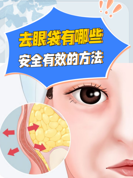 去眼袋手术