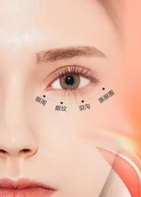 去眼袋手术