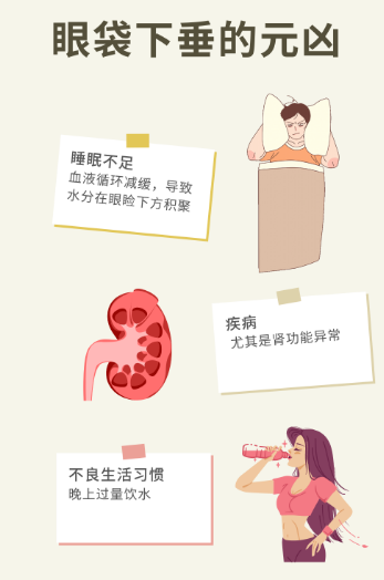 去眼袋手术