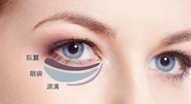 去眼袋手术