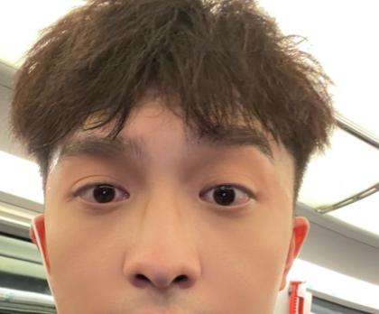 去眼袋手术