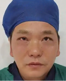 去眼袋手术