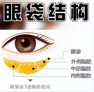 眼袋