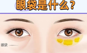 去眼袋手术