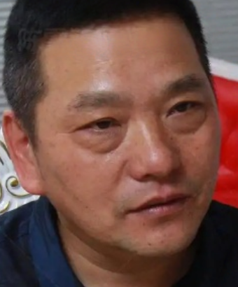去眼袋手术