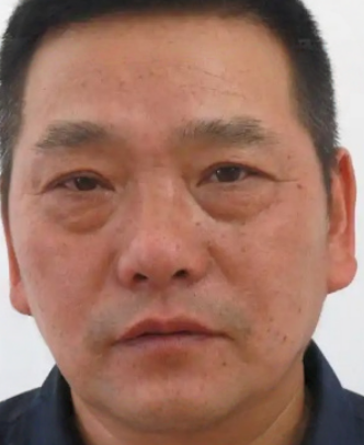 去眼袋手术