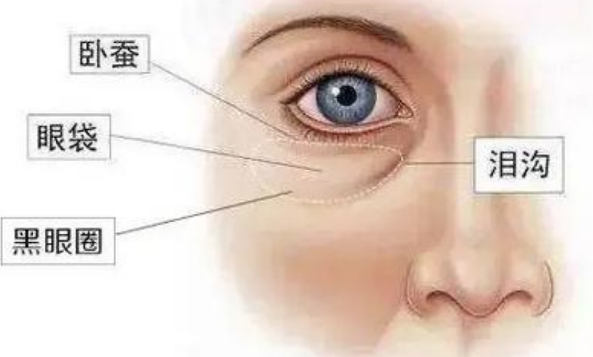 去眼袋手术