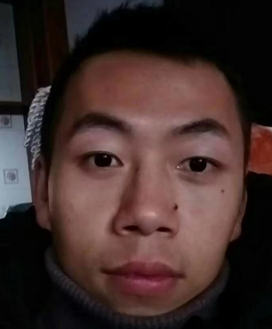 去眼袋手术