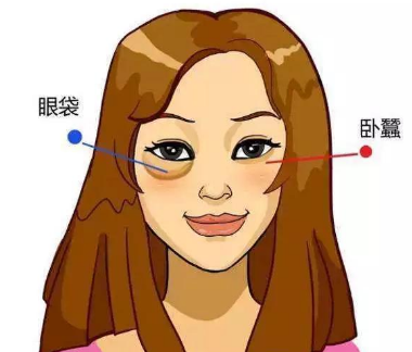去眼袋手术