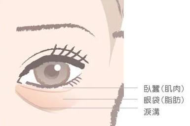 去眼袋手术
