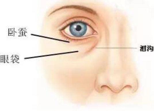 眼袋
