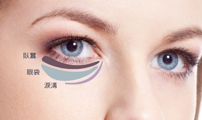 眼袋