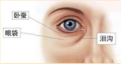 眼袋