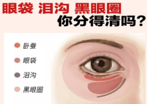 去眼袋手术