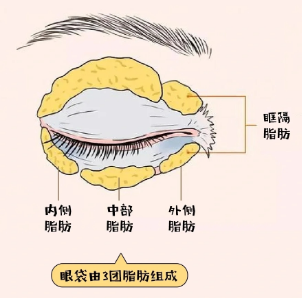 眼袋
