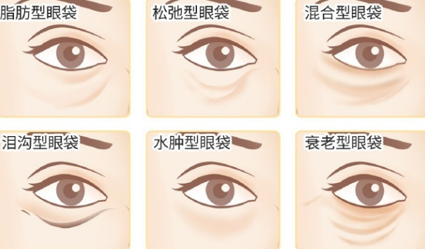 眼袋