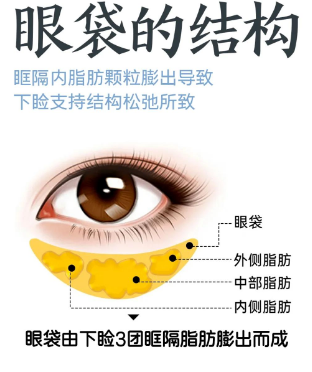 眼袋