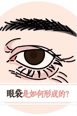 眼袋