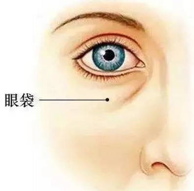 眼袋